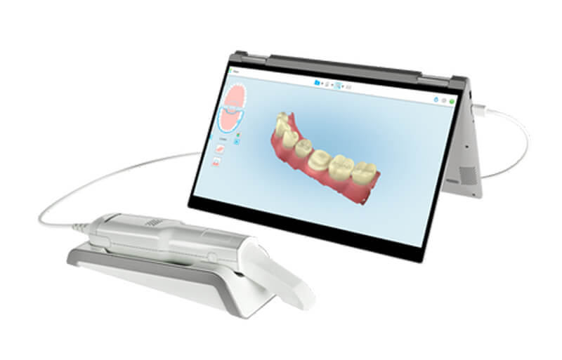 Dental-Labor Michl GmbH - Digitale Dentaltechnik an 4 Standorten - Intraoralscannen
